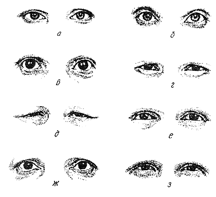 Рис. 38. Контур глазной щели: а - миндалевидный; б - овальный; в - круглый; г - треугольный; д - щелевидный; е - сегментовидный; ж - типа ракетки; з - серповидный